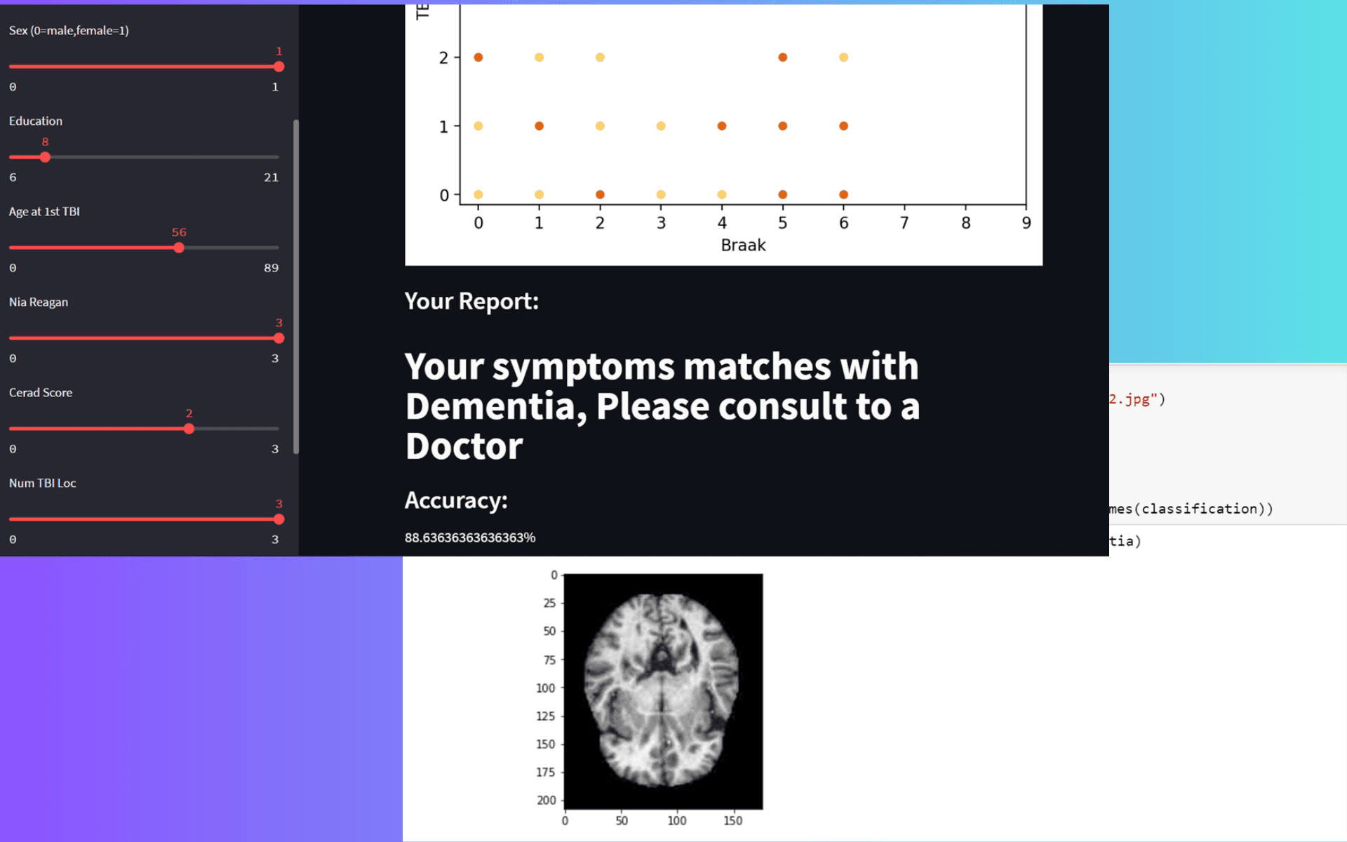 Prediction of Dementia